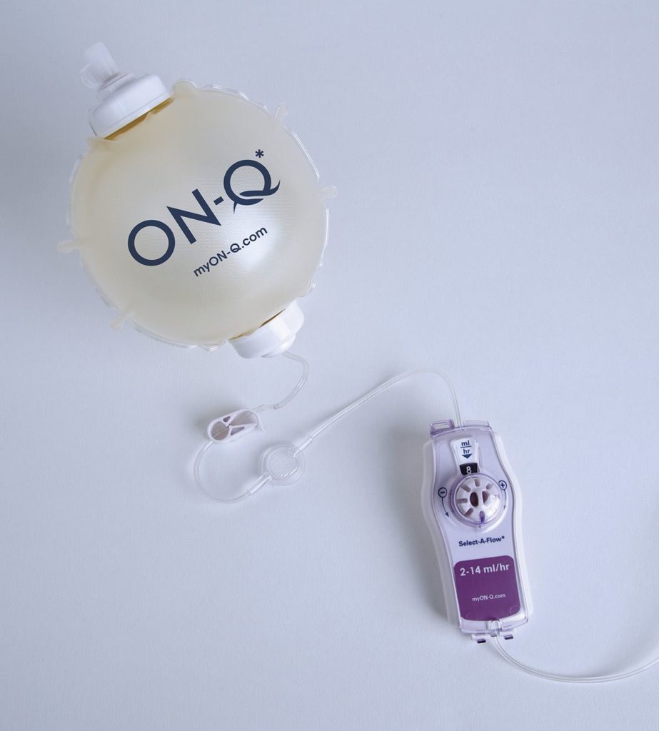 The ON-Q pain relief pump can help reduce reliance on prescription painkillers after surgery.
