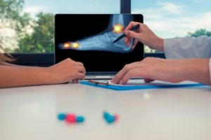 Among other podiatric treatments, an arthroplasty is used to straighten misshapen toes in order to alleviate joint pain.